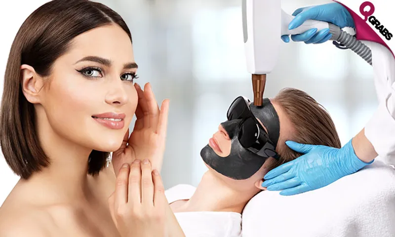 Carbon Peel & Laser Lightening or Toning Treatments!